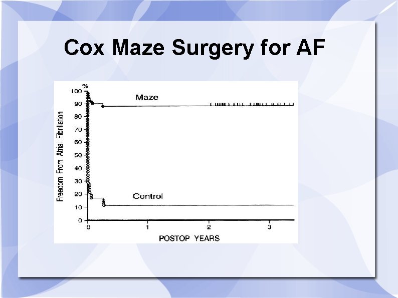 Cox Maze Surgery for AF 