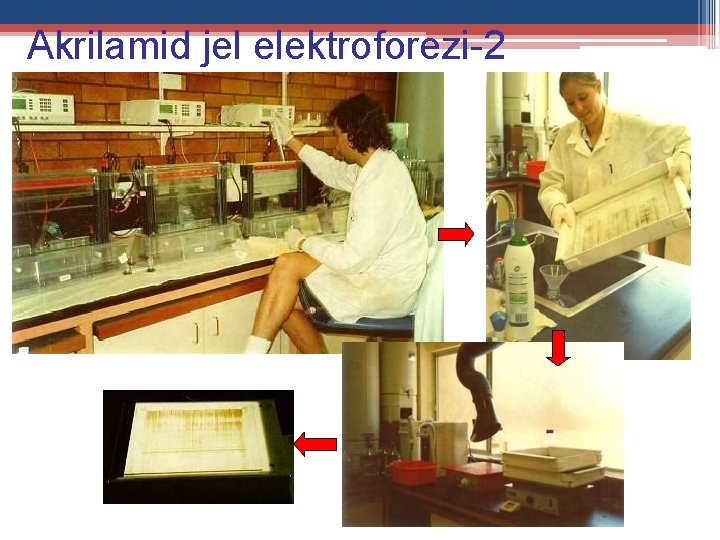 Akrilamid jel elektroforezi-2 