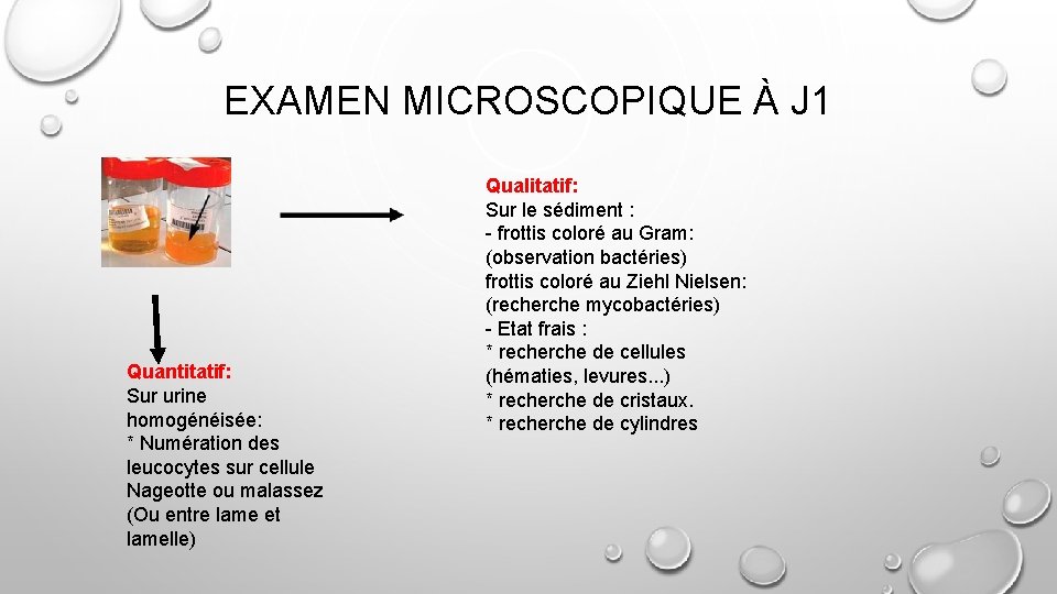 EXAMEN MICROSCOPIQUE À J 1 Quantitatif: Sur urine homogénéisée: * Numération des leucocytes sur