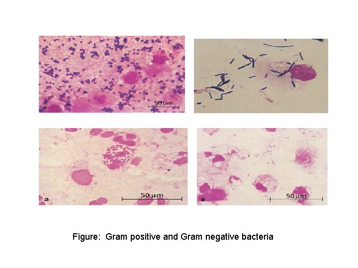 Figure: Gram positive and Gram negative bacteria 