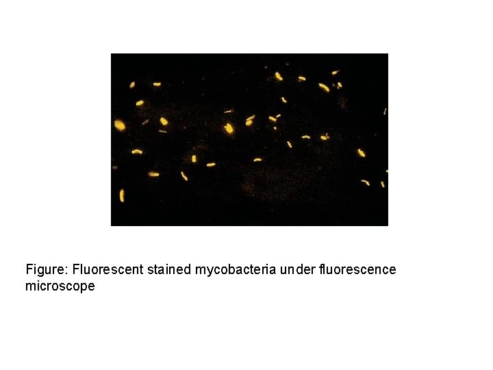 Figure: Fluorescent stained mycobacteria under fluorescence microscope 