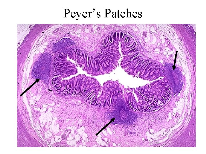 Peyer’s Patches 