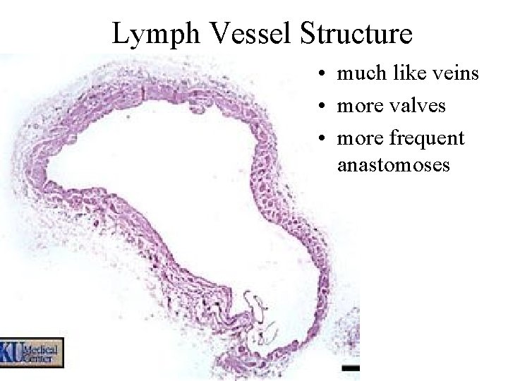 Lymph Vessel Structure • much like veins • more valves • more frequent anastomoses