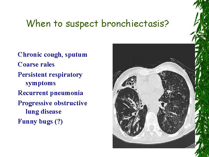 When to suspect bronchiectasis? Chronic cough, sputum Coarse rales Persistent respiratory symptoms Recurrent pneumonia