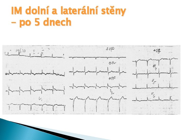 IM dolní a laterální stěny – po 5 dnech 