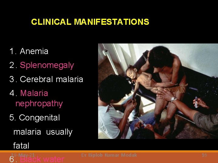 CLINICAL MANIFESTATIONS 1. Anemia 2. Splenomegaly 3. Cerebral malaria 4. Malaria nephropathy 5. Congenital