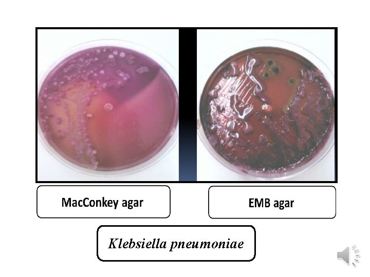 Klebsiella pneumoniae 