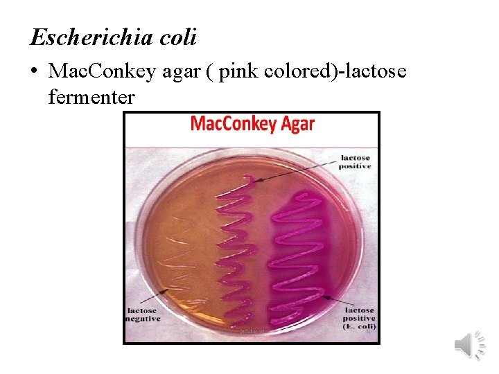 Escherichia coli • Mac. Conkey agar ( pink colored)-lactose fermenter 