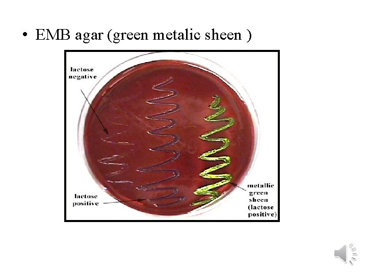  • EMB agar (green metalic sheen ) 