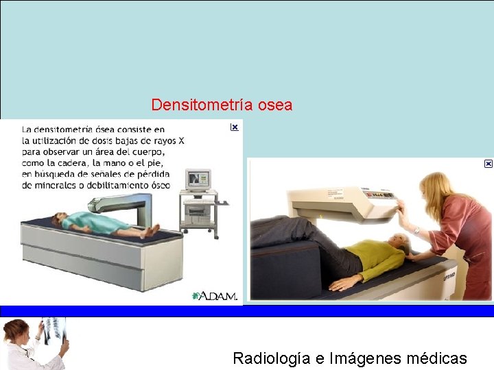 Densitometría osea Radiología e Imágenes médicas 