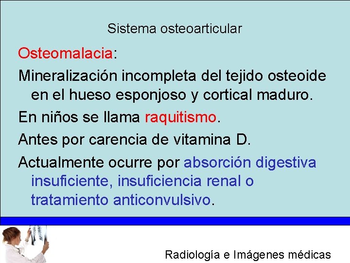 Sistema osteoarticular Osteomalacia: Mineralización incompleta del tejido osteoide en el hueso esponjoso y cortical