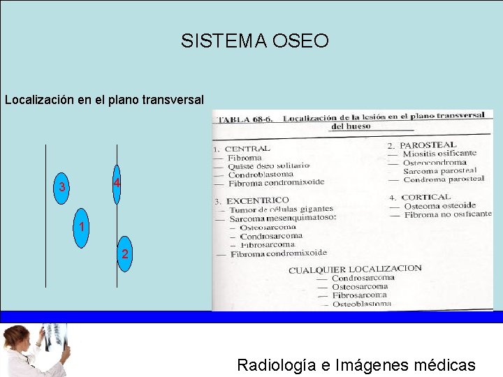 SISTEMA OSEO Localización en el plano transversal 4 3 1 2 Radiología e Imágenes