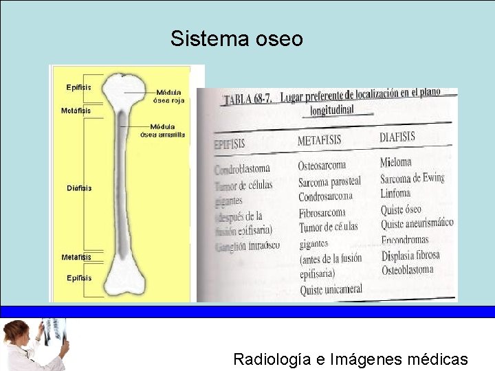 Sistema oseo Radiología e Imágenes médicas 