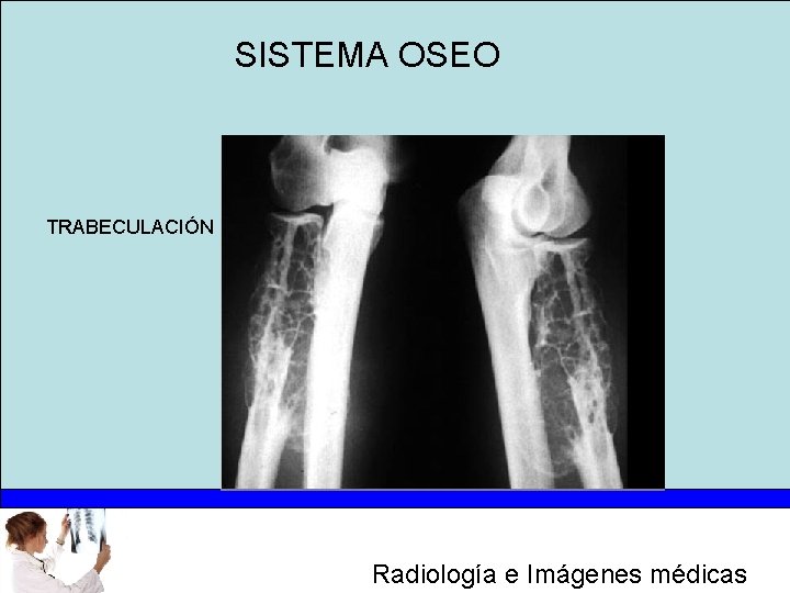 SISTEMA OSEO TRABECULACIÓN Radiología e Imágenes médicas 