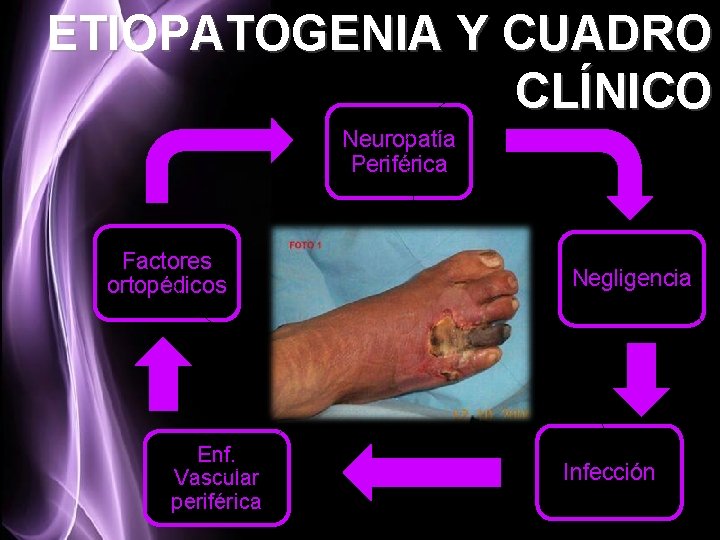 ETIOPATOGENIA Y CUADRO CLÍNICO Neuropatía Periférica Factores ortopédicos Enf. Vascular periférica Negligencia Infección 