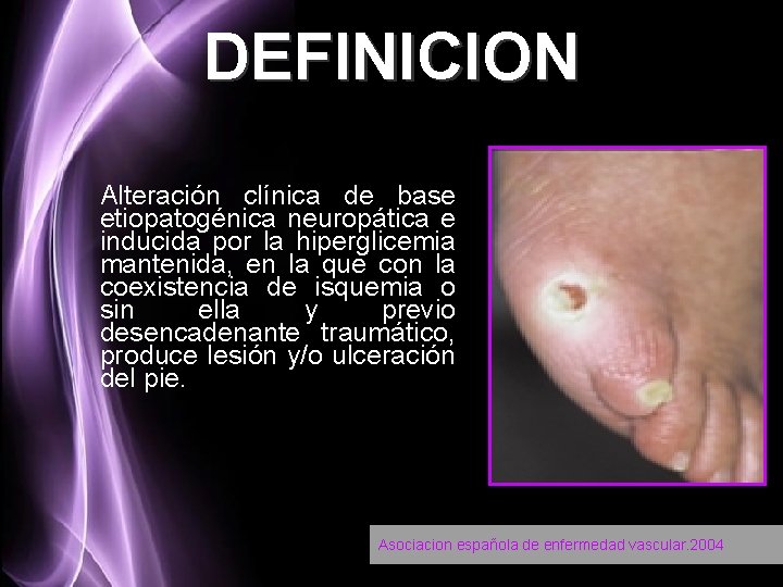 DEFINICION Alteración clínica de base etiopatogénica neuropática e inducida por la hiperglicemia mantenida, en