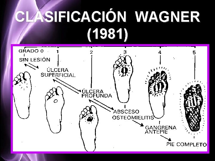 CLASIFICACIÓN WAGNER (1981) 