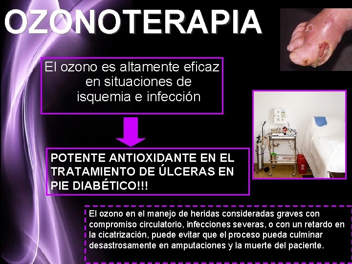 OZONOTERAPIA El ozono es altamente eficaz en situaciones de isquemia e infección POTENTE ANTIOXIDANTE