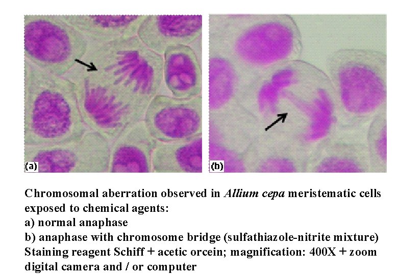 Chromosomal aberration observed in Allium cepa meristematic cells exposed to chemical agents: a) normal