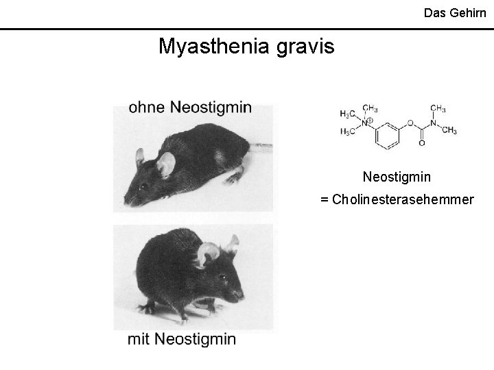 Das Gehirn Myasthenia gravis Neostigmin = Cholinesterasehemmer 