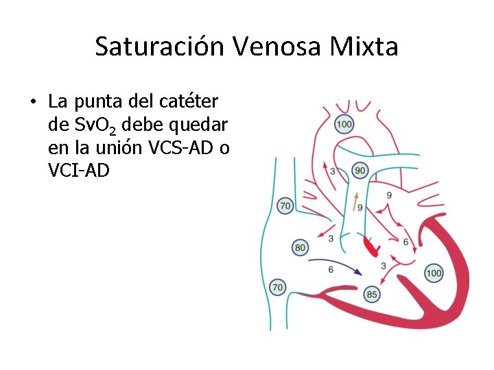 Saturación Venosa Mixta • La punta del catéter de Sv. O 2 debe quedar