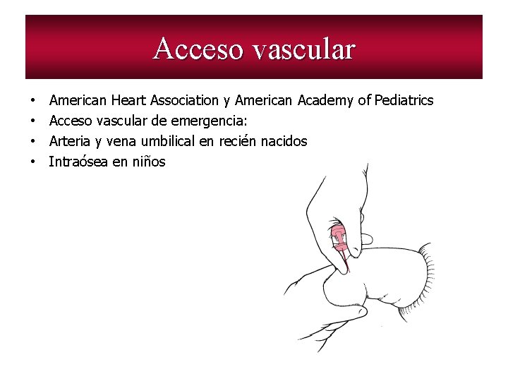 Acceso vascular • • American Heart Association y American Academy of Pediatrics Acceso vascular