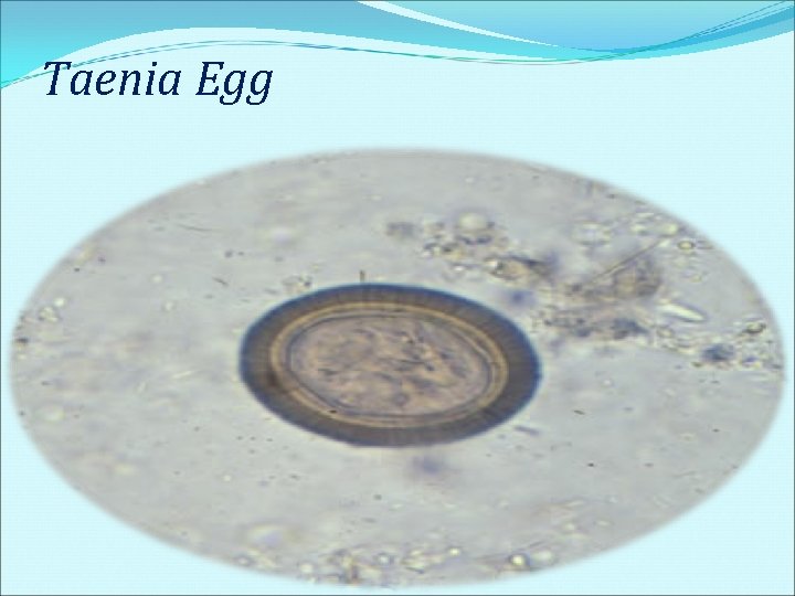 Taenia Egg Taenia Egg