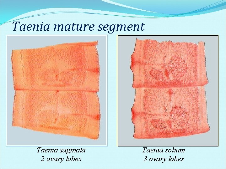Taenia mature segment Taenia saginata 2 ovary lobes Taenia solium 3 ovary lobes Taenia mature segment Taenia saginata 2 ovary lobes Taenia solium 3 ovary lobes