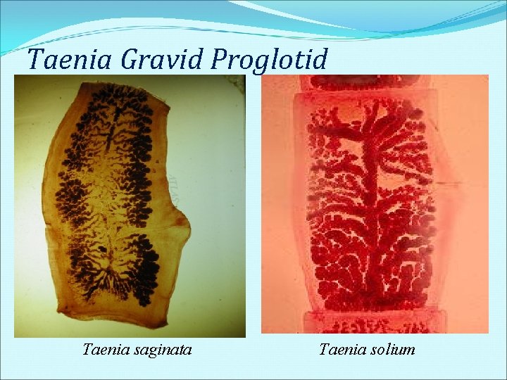 Taenia Gravid Proglotid Taenia saginata Taenia solium Taenia Gravid Proglotid Taenia saginata Taenia solium