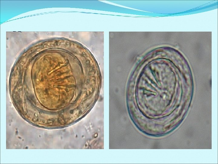 H. nana egg H. nana egg