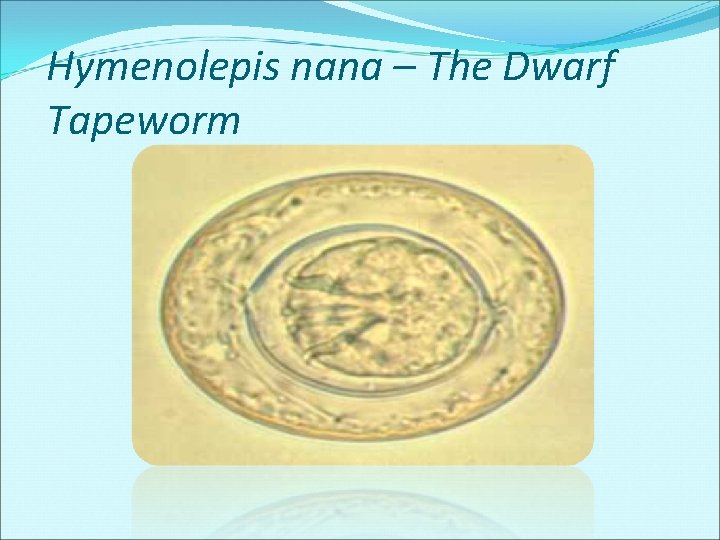 Hymenolepis nana – The Dwarf Tapeworm Hymenolepis nana – The Dwarf Tapeworm