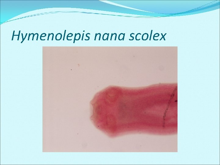 Hymenolepis nana scolex Hymenolepis nana scolex