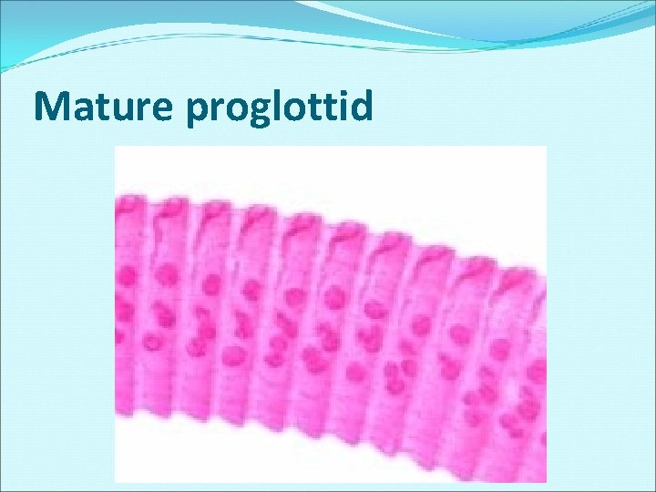 Mature proglottid Mature proglottid