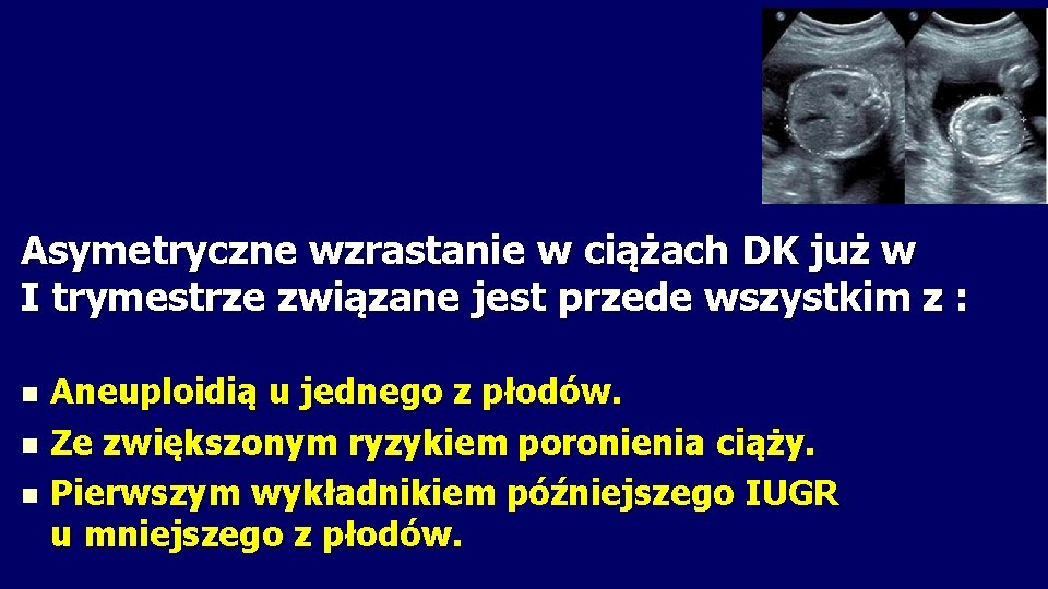 Asymetryczne wzrastanie w ciążach DK już w I trymestrze związane jest przede wszystkim z