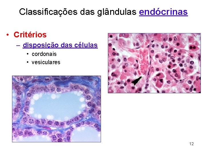 Classificações das glândulas endócrinas • Critérios – disposição das células • cordonais • vesiculares