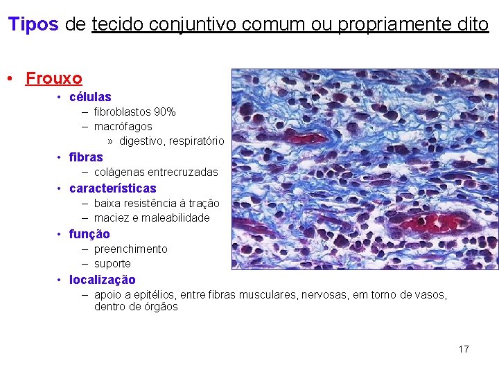 Tipos de tecido conjuntivo comum ou propriamente dito • Frouxo • células – fibroblastos