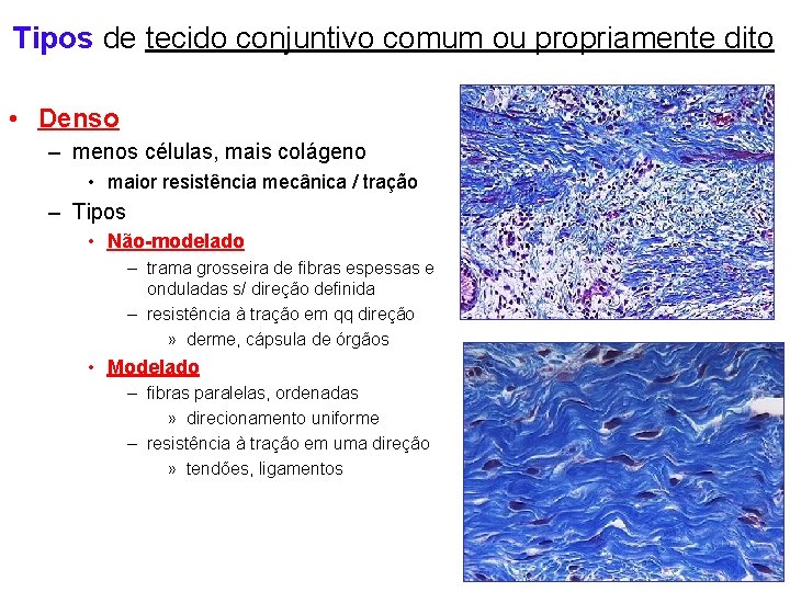 Tipos de tecido conjuntivo comum ou propriamente dito • Denso – menos células, mais