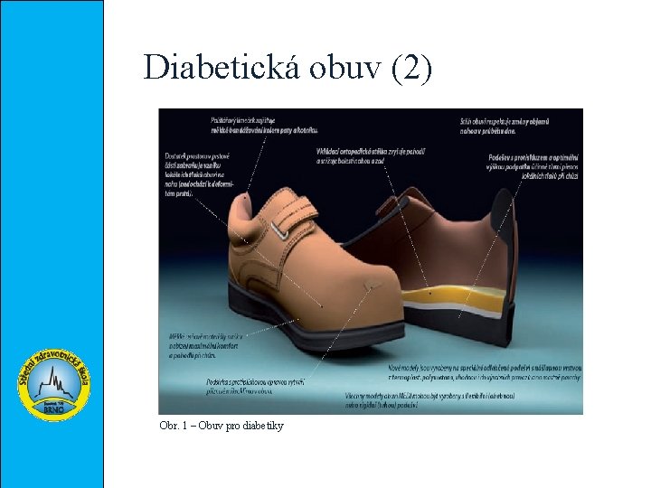 Diabetická obuv (2) Obr. 1 – Obuv pro diabetiky 