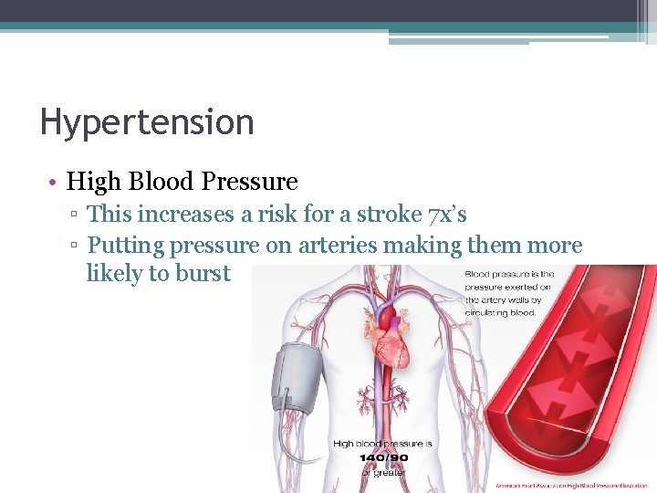Hypertension • High Blood Pressure ▫ This increases a risk for a stroke 7