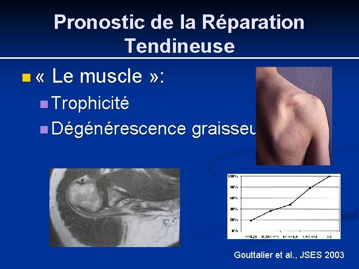Pronostic de la Réparation Tendineuse n « Le muscle » : n Trophicité n