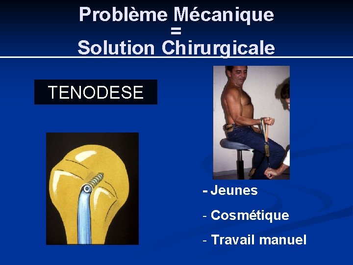 Problème Mécanique = Solution Chirurgicale TENODESE - Jeunes - Cosmétique - Travail manuel 
