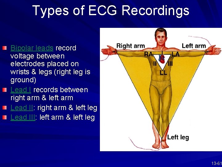 Types of ECG Recordings Bipolar leads record voltage between electrodes placed on wrists &