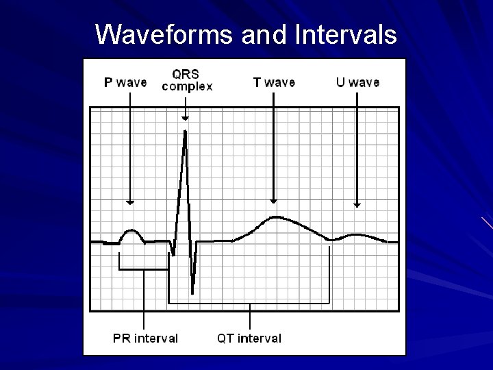 Waveforms and Intervals 