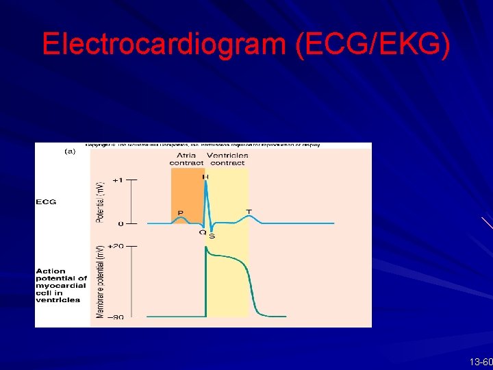 Electrocardiogram (ECG/EKG) 13 -60 