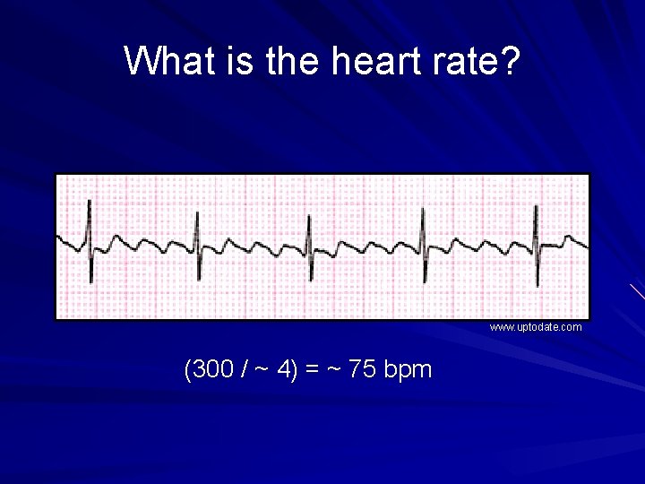 What is the heart rate? www. uptodate. com (300 / ~ 4) = ~