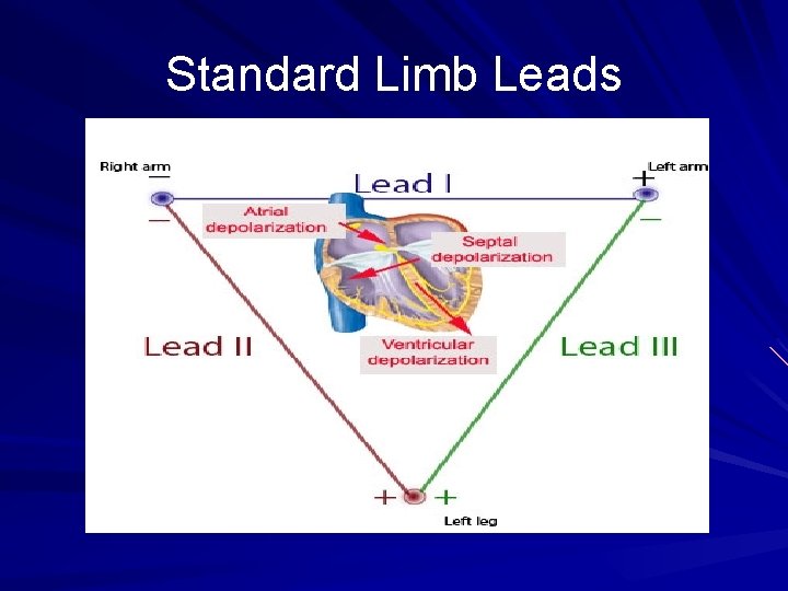 Standard Limb Leads 