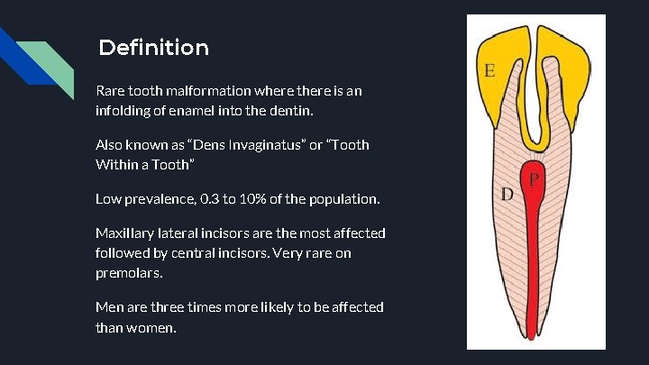 Definition Rare tooth malformation where there is an infolding of enamel into the dentin.