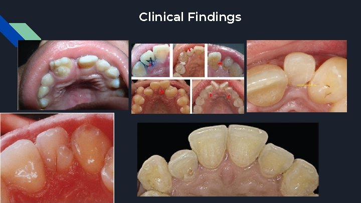 Clinical Findings 