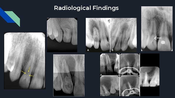 Radiological Findings 