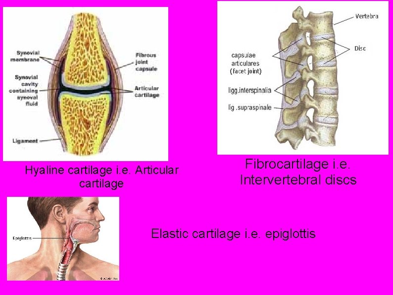 Hyaline cartilage i. e. Articular cartilage Fibrocartilage i. e. Intervertebral discs Elastic cartilage i.